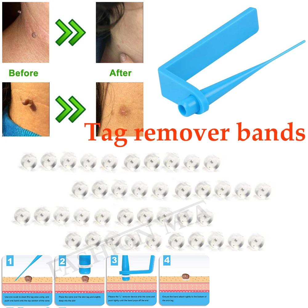 Medical Skin Tag Removal Bands Skin Tag Removal Kit With Cleansing Swabs Adult Mole Wart Remove Acne Treatments Face Skin Care Face Skin Care Machine Aliexpress