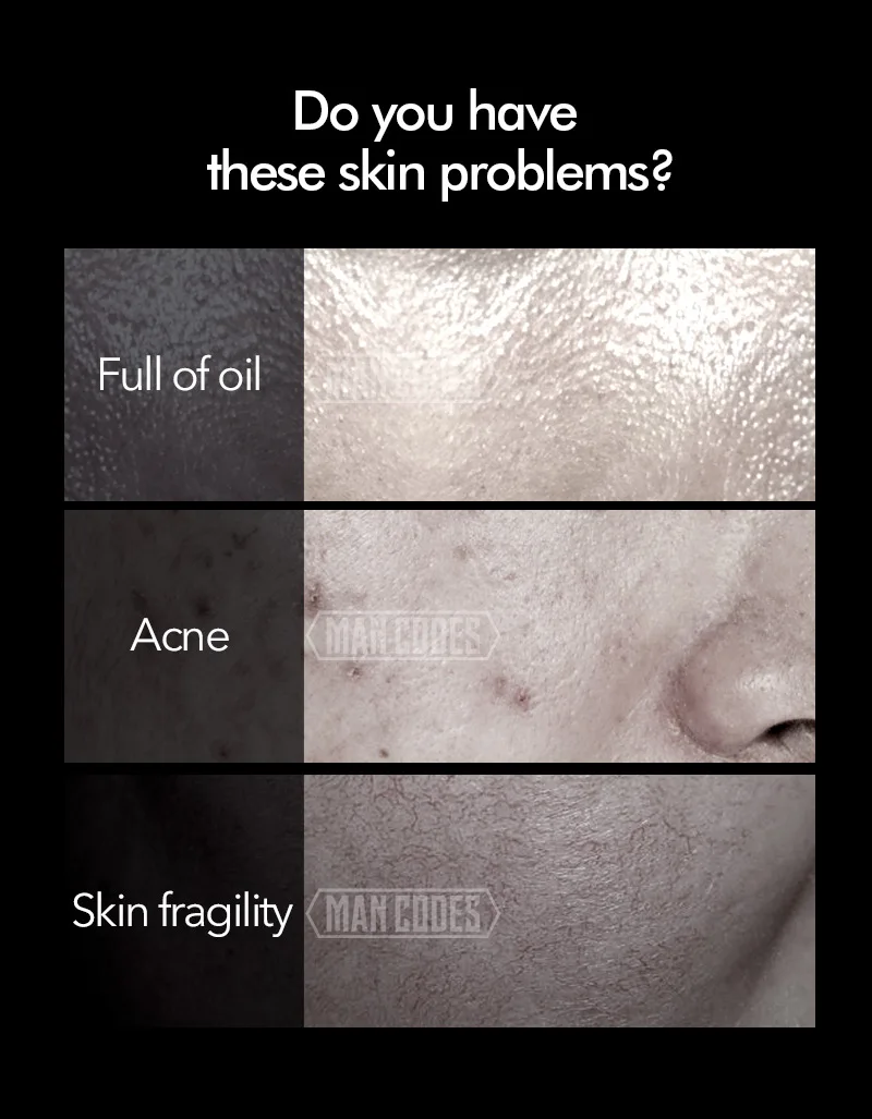 3Pcs Men Brightening Skin Care Set Cleanser& Toner& Lotion Moisturizing Anti Aging Smooth Daily Facial Care 20+15+15ml