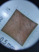 Lupa con mango de dermatoscopio 10X, visión clara suave con escala de medida, 30X, tipo B, visión más grande con luz UV