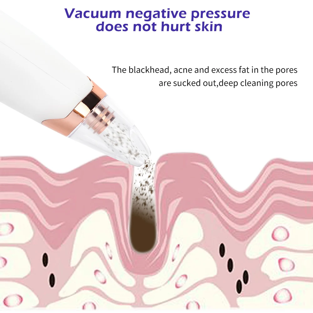 Новинка, устройство для удаления черных точек с лица, вакуумный уход за кожей, очиститель пор, Удаление прыщей, вакуумный инструмент для удаления прыщей