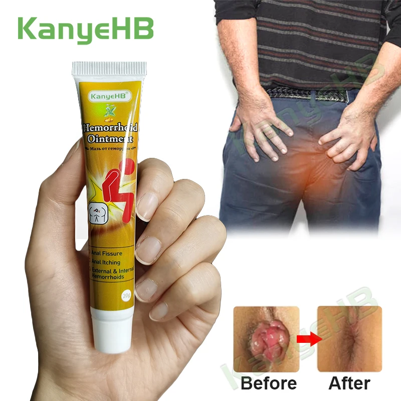 1 шт. антибактериальный крем от геморроя внутренней и внешней трещины | Красота