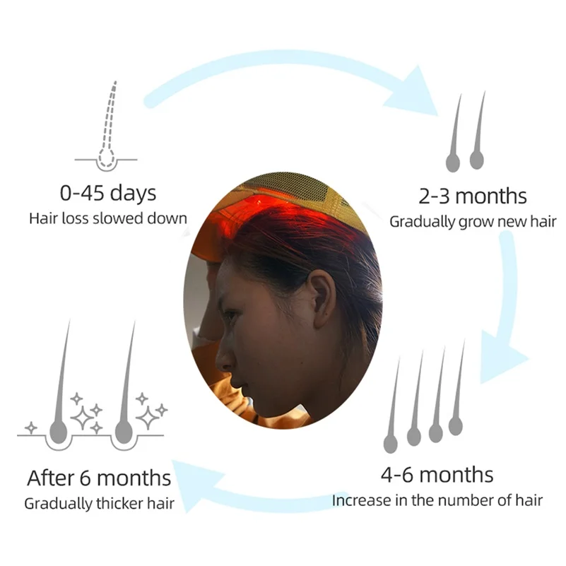 Hair Regrowth Laser Cap Medical Treatment Grow Fast Hair Growth Cap