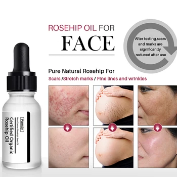

Face Serum Rosehip Oil Anti-Aging Whitening Moisturizer Rose Hip Essential Oil Skin Care Acne Scar Serum Stretch Marks Remover