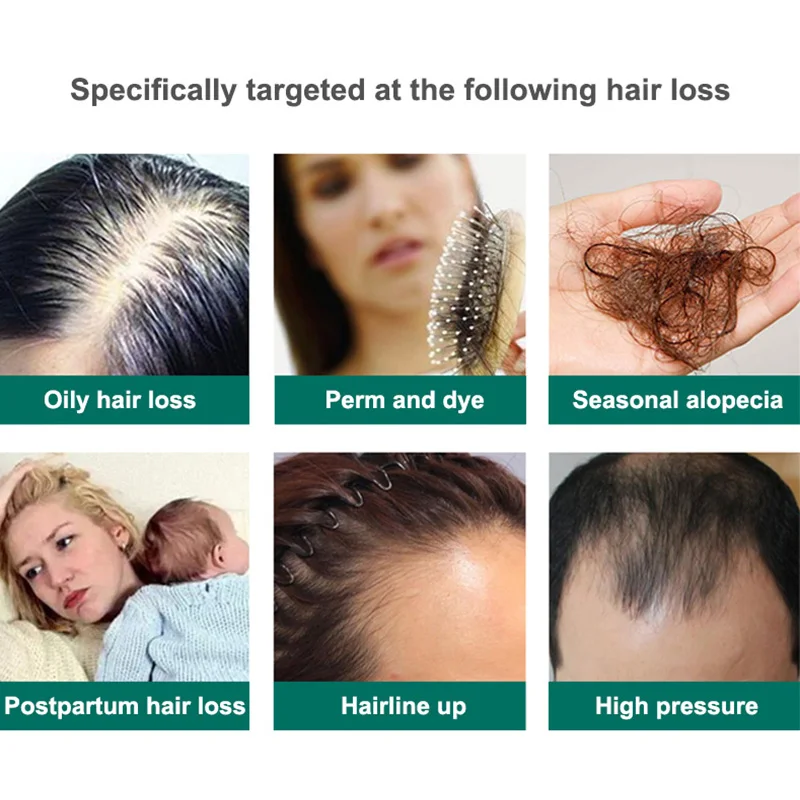 360g Hair Shedding Proof Shampoo Zhangguang 101 RESHOW Chinese HERBAL Shampoo Anti Hair Loss Powerful Stop Loss hair care products