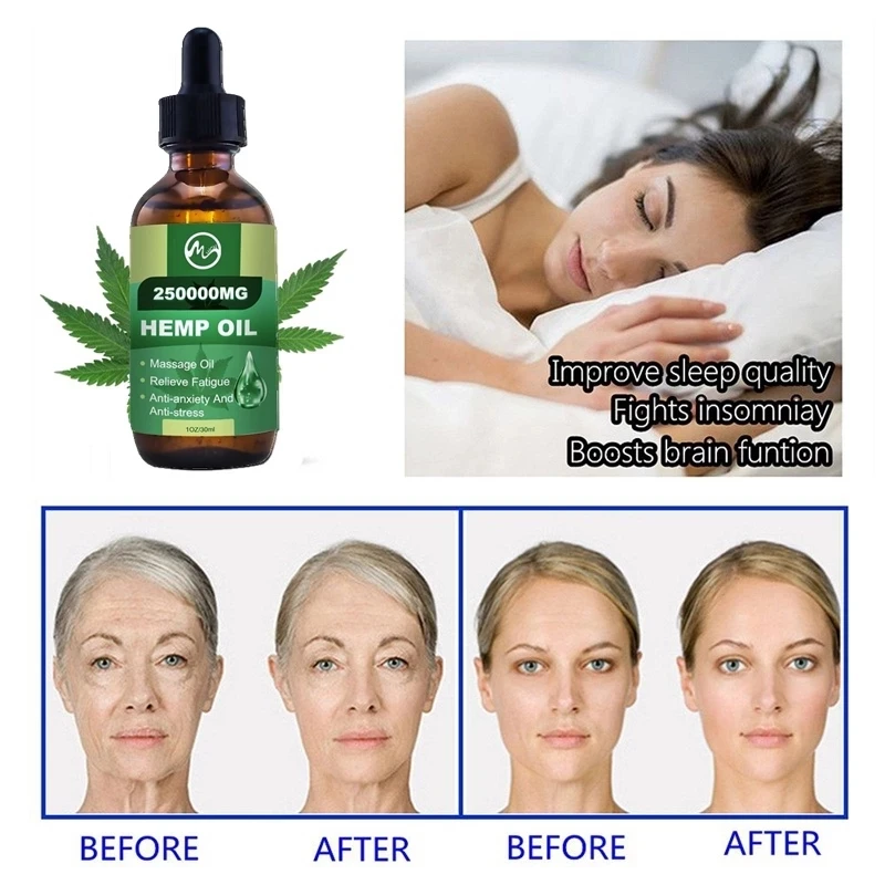 Minch-250000MG-CBD-Skin-Oil-Hemp-Pain-Relief-Oil-Reduce-Anxiety-Help-Sleep-Anti-inflammatory-Herbal.jpg_Q90.jpg_.webp (4)