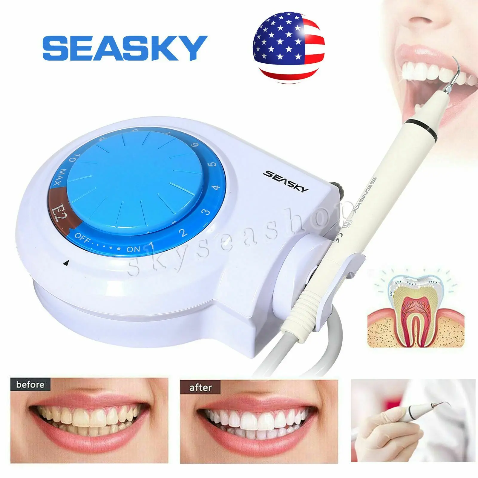 ทันตกรรม Piezo Ultrasonic Scaler Scaling Handpiece สำหรับ Cavitron EMS