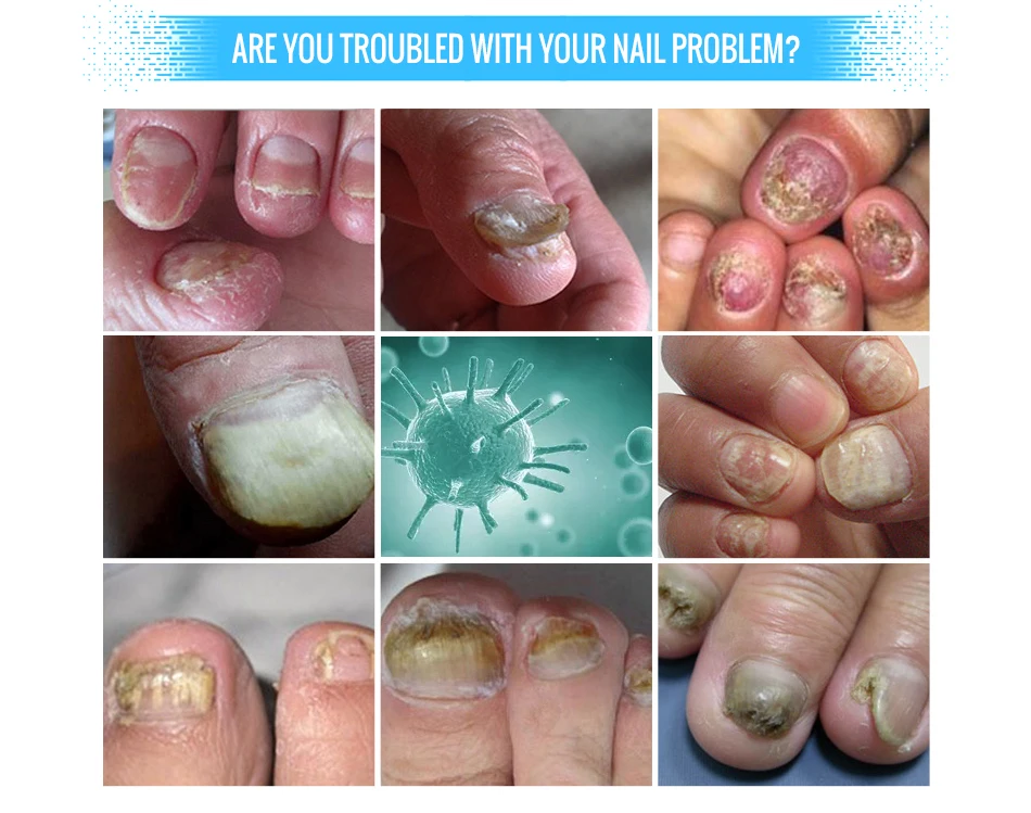 指甲护理精华详情_03