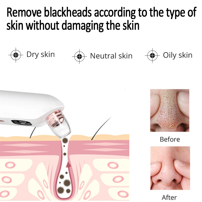 Blackhead remover acne cleansing pores black dot electric cleaner blackheads acne facial vacuum cleaner beauty skin 3