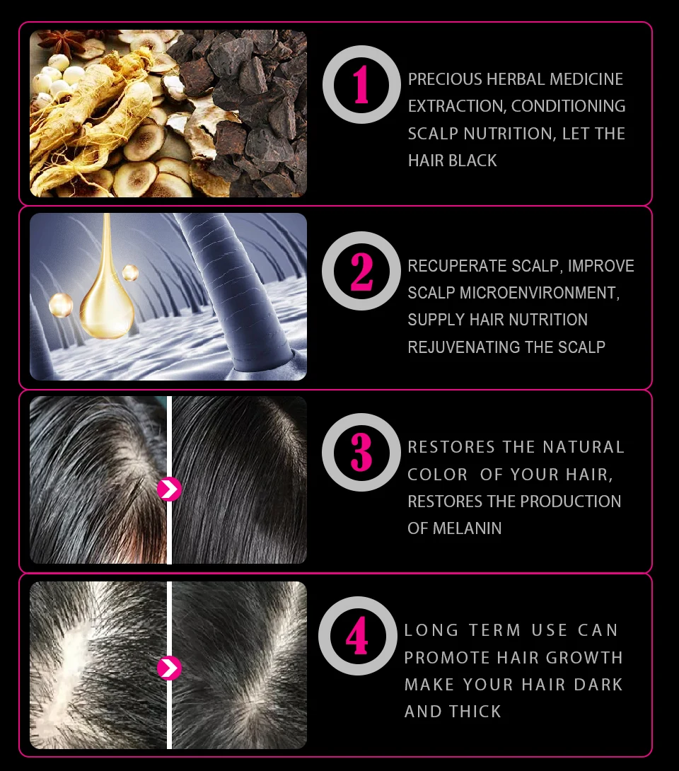 Sevich Hair Growth Spray Grey Hair Treatment Restoration Black Hair Anti Hair Loss White Hair Repair Serum Hair Loss Product Sevich Hair Growth Spray Grey Hair Treatment Restoration Black Hair Anti Hair Loss White Hair Repair Serum Hair Loss Product