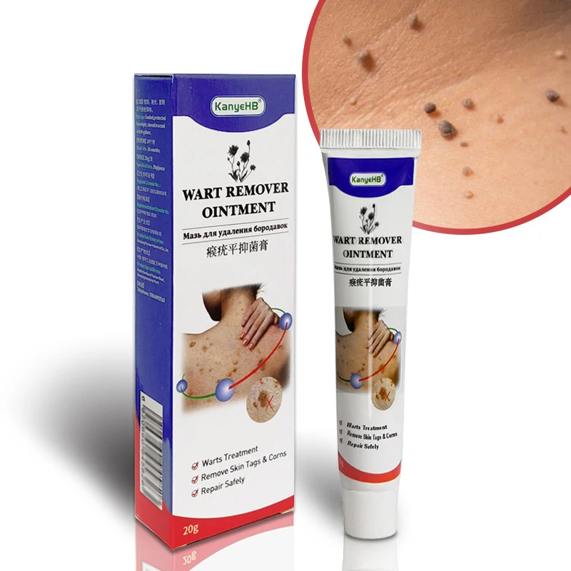 Wart Ointment Genital Herpes Skin Remover Antibacterial Treatment Cream Creams AliExpress