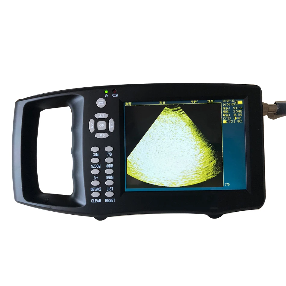 Portable-Pig-Ultrasound-Veterinary-Animal-Pregnancy-Test-Instrument-Color-B-Mode-Ultrasonography-Ultrasonic-Detector (2)