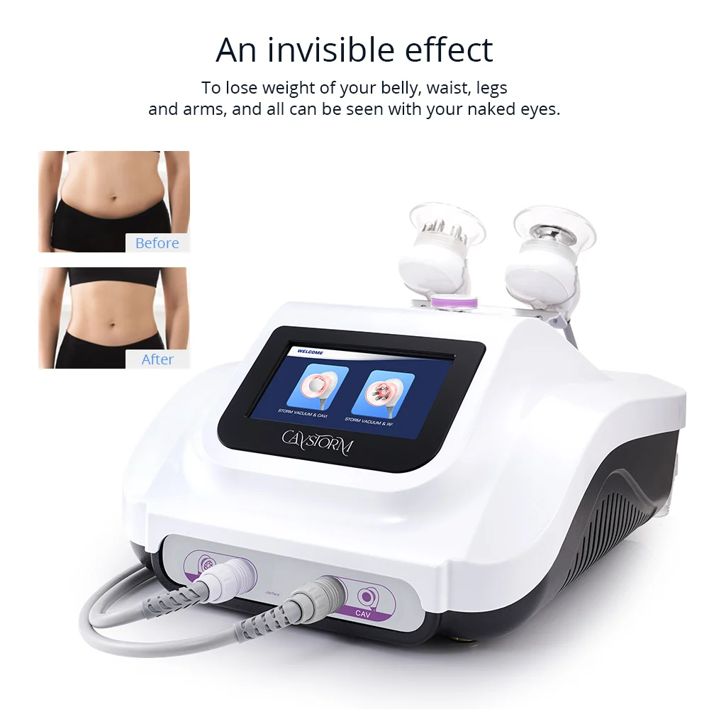 Ultrasound Cavitation Inch Loss - Skin Tech Clinic