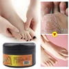 Horse Oil Feet Cream Heel Cream for Foot Feet Mask Itch Blisters Anti-chapping Peeling Repair for Foot Care Cream Pedicure 45g ► Photo 3/6