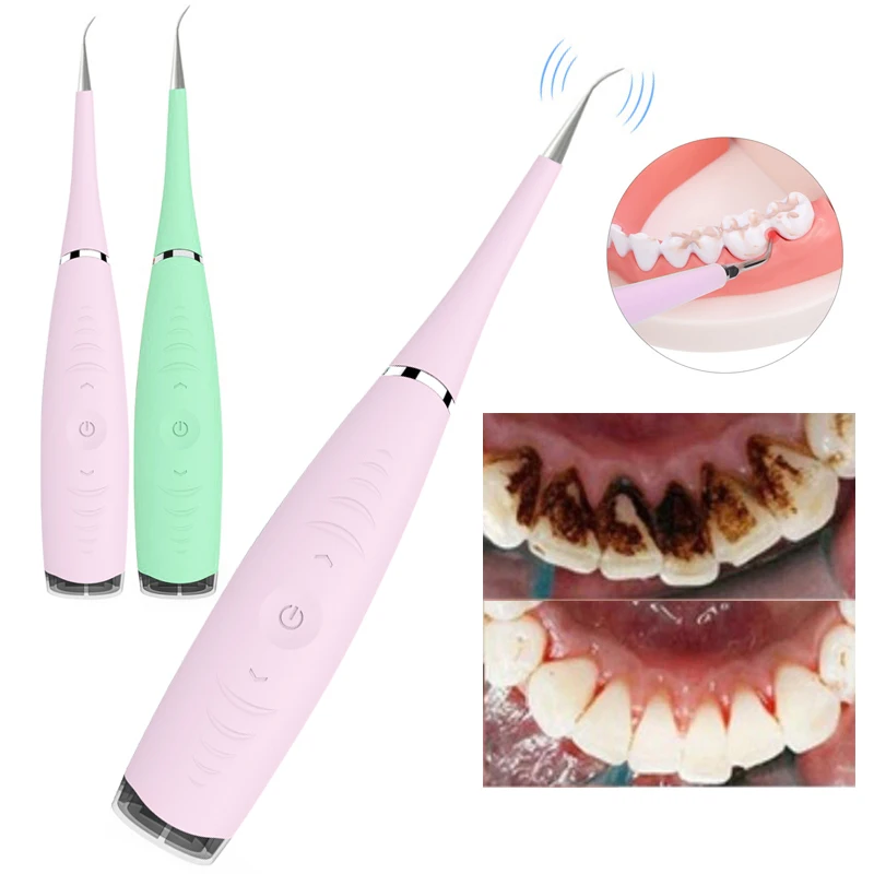 Электрическая звуковая стоматологических масштабирования зуб исчисление Remover отбеливание зубов Красители инструмент стоматолог