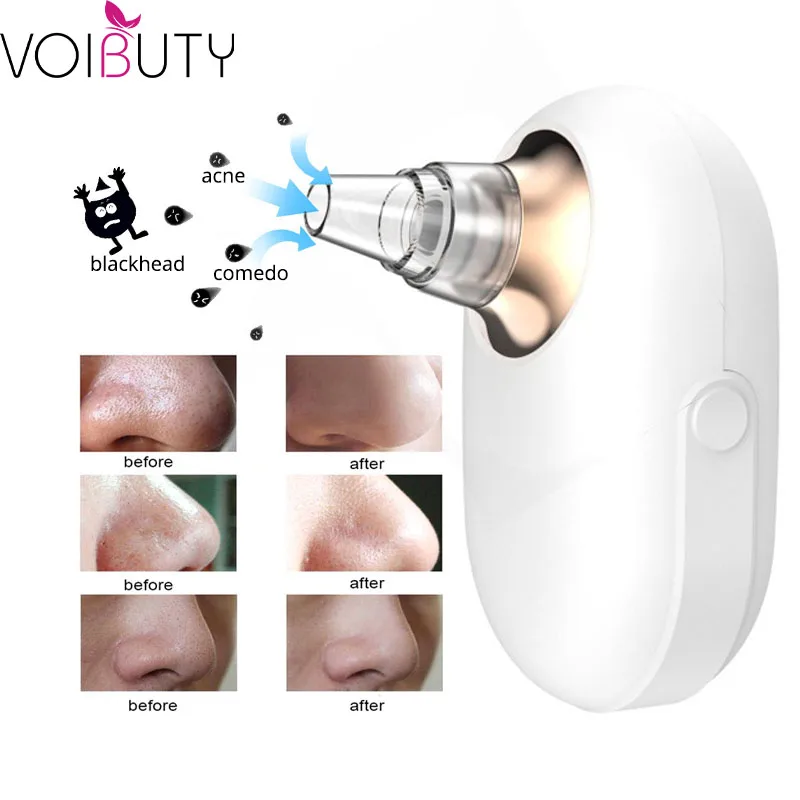 

Blackhead Remover Vacuum Pore Cleaner Acne Comedones Removal Black Head Remover Face Care Pimples Tools Comedone Extractor