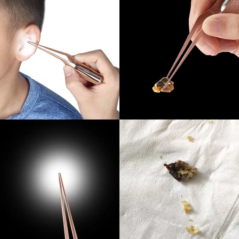 

Baby Adult Children Ear Cleaning NIE Sub-Infants Earwax Visual Ear Cleaning Kids Tweezers Lighting Earpick