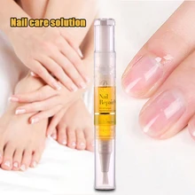 Ручка для ремонта ногтей Уход за ногтями обновление фиксирует жидкость для ногтей Ноготь на ногах 5 мл NShopping
