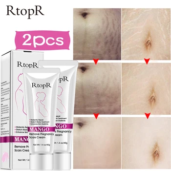 

2PCS Mango Stretch Marks Repair Cream Remove Pregnancy Scars Acne Treatment Maternity Anti-Aging Anti Wrinkle Firming Body Cream