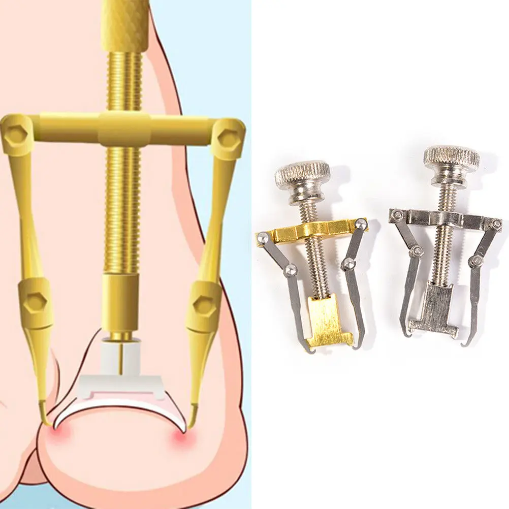 Stainless Steel Fixer Recover Toe Paronychia Nail Brace Tools Ingrown