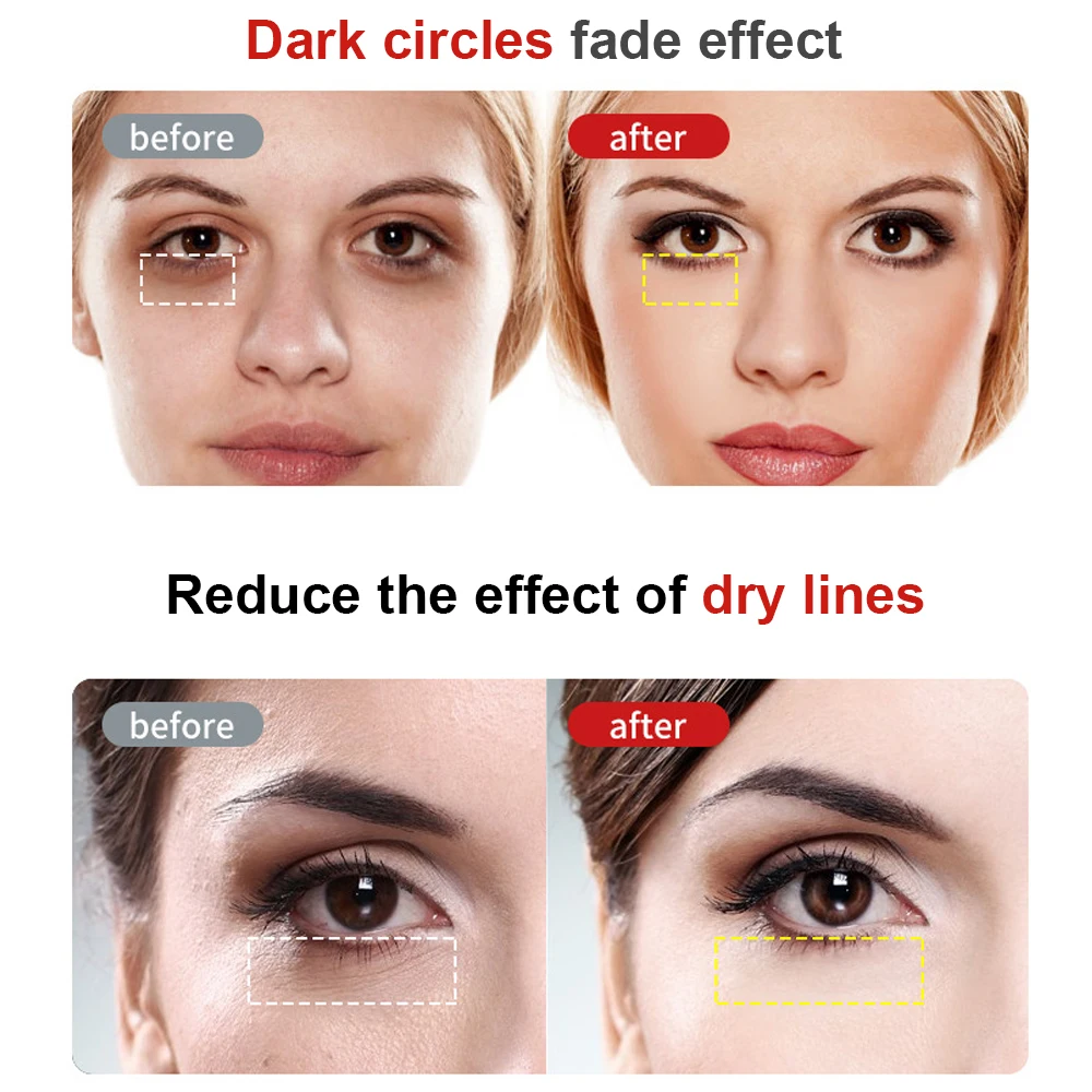 Electric Eye Massager Pen Dark Circle Facials Vibration Thin Face Anti Bag Pouch & Wrinkle Radio Frequency Beauty Tool 5 colors Eye Massager