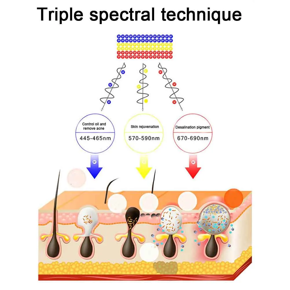 USB Charging Tightening Light Therapy Vibration Skin Rejuvenation Eye Portable LED Facial Mask Travel Spa Wrinkle 1 USB Charging Tightening Light Therapy Vibration Skin Rejuvenation Eye Portable LED Facial Mask Travel Spa Wrinkle 3