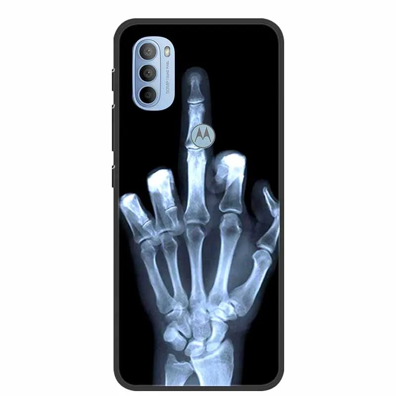 Charming Cat Design Soft TPU Silicone Phone Case - Motorola Moto Series