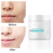 200g Face Wound Repair Serum Corrector Professional Wound Regeneration Scar Mark Cell Healing acne Repair and Cream