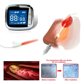 

Healthcare 650nm Laser Light/Wrist Diode Low Level Laser Physiotherapy Therapy LLLT for Diabetes Hypertension Rhinitis Treatment