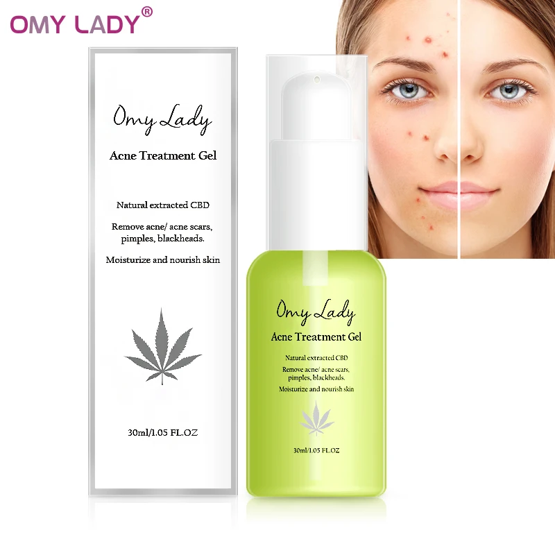 

OMY LADY Acne Treatment Face Serum Blackhead Remove Anti Acne Cream Oil Control Shrink Pores Acne Scar Remove Skin Whitening