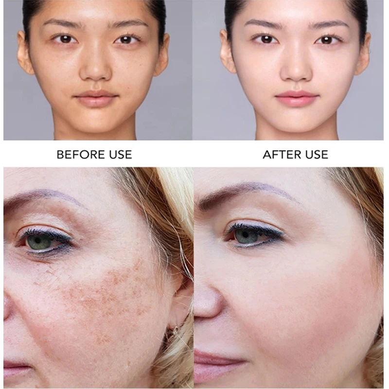 AILKE Superior Lightening Face Serum, Moisturize, Hydration, Remove Hyperpigmentation, Even Skin Tone, Clean Skin With Vitamin C