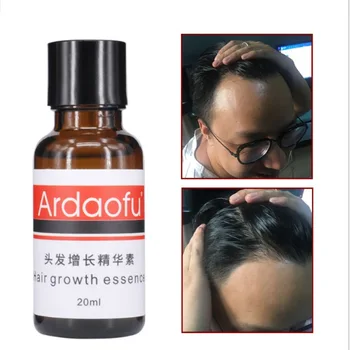 

Fast Hair Growth Essential Oil Anti Preventing Hair Lose Liquid Damaged Hair Repair Growing Essential Oil Women Men