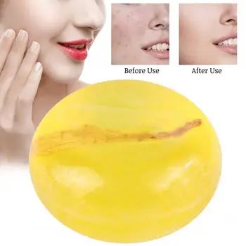 

Handmade Soap Face Body Cleaning Mite Removal Blackhead Soap Oil Control Skin Moisturizing Soap Skin Care Body Soap