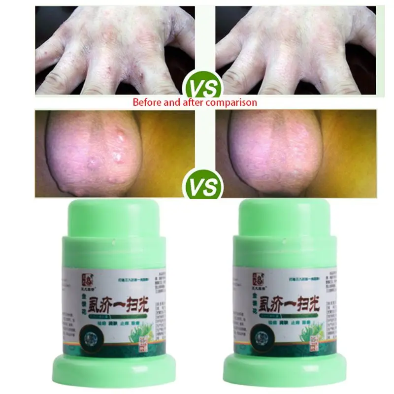 15g Chinese Herbal Multipurpose Anti-Itch Cream for Itching Rushes from Louse Bug Mite Bites Soothing Ointment Balm Skin Care