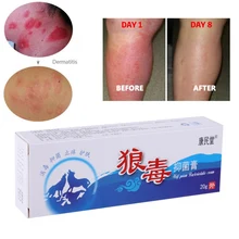 Быстро бактериостатический анти-мазь против зуда анти-пилинг удалить запах Уход за ногами Крем китайская медицина