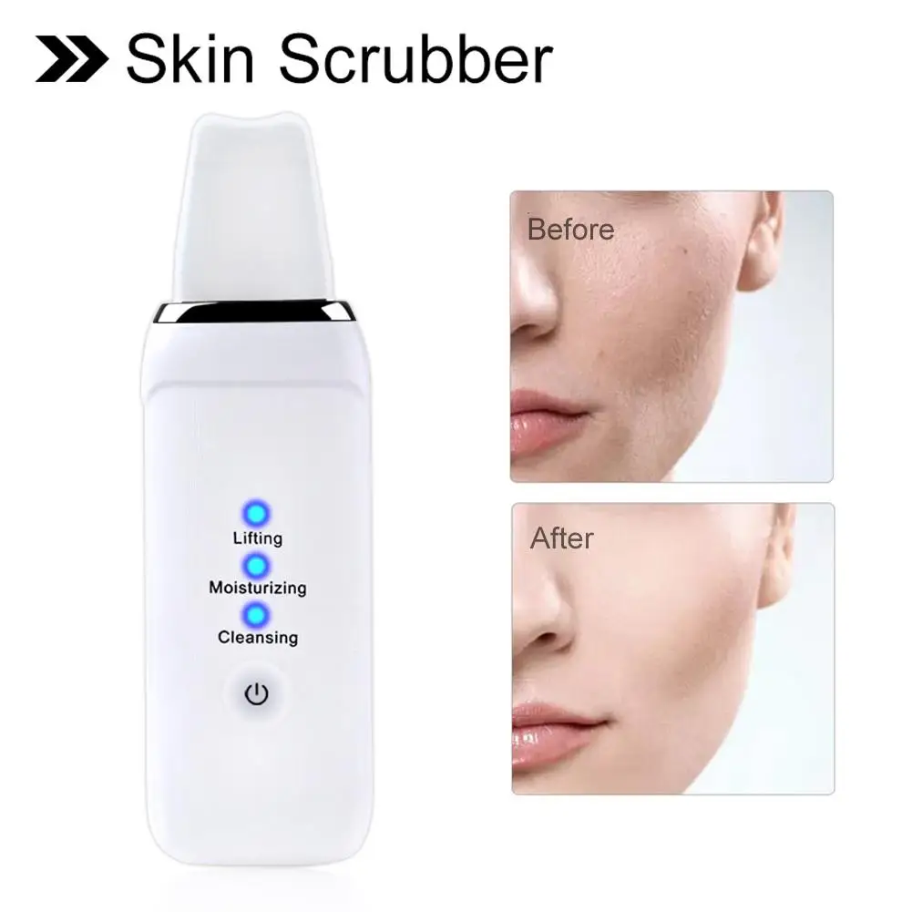  Skin Scrubber Scraper And Gentle Peel Device Cordless Pore Cleanser & Exfoliator Comedone Extractor