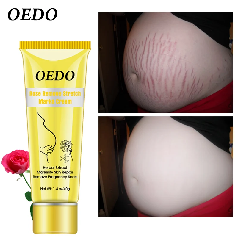 oedo cream price