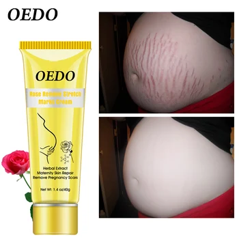 

OEDO Rose Remove Stretch Mark Cream Nourish Moisturizing Anti-wrinkle Pregnant Women Skin Repair Remove Obesity Tattoo Body Care