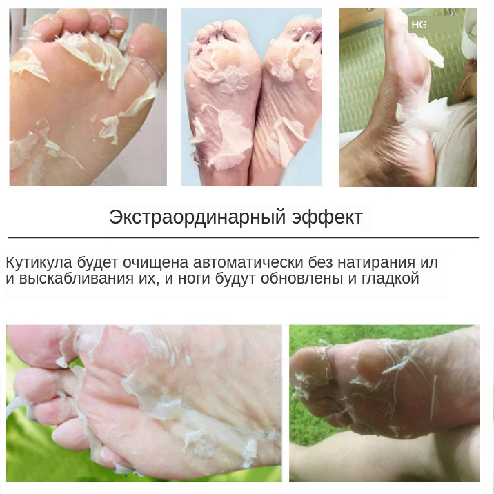 Exfoliating-socks-(2)