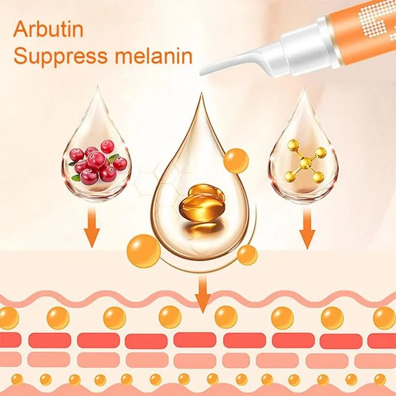 15ml Instant Blemish Removal Gel Vitamin C Whitening Anti Freckle Cream Pen Effective Remove the Freckle Pigmented Melanin Spots 15ml Instant Blemish Removal Gel Vitamin C Whitening Anti Freckle Cream Pen Effective Remove the Freckle Pigmented Melanin Spots