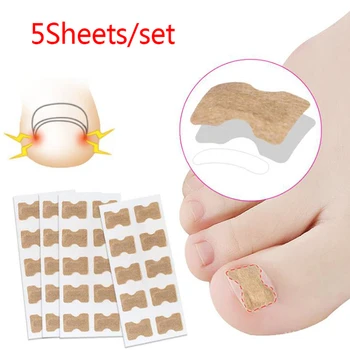 

Ingrown Toenail Corrector Stickers Paronychia Treatment Recover Corrector Pedicure Tools Fingernail Toe Nail Care 5pcs/Pack