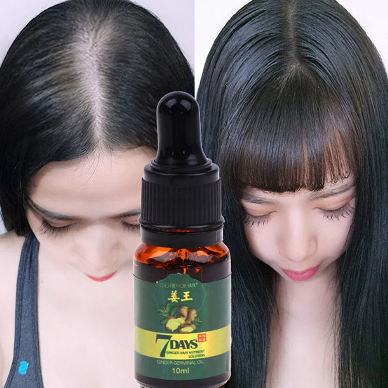 Ginger 7 Days Hair Care Ginger Germinal Essential Oil Polygonum Anti-Hair Loss 10ml Dry And Damaged Hair Nutrition
