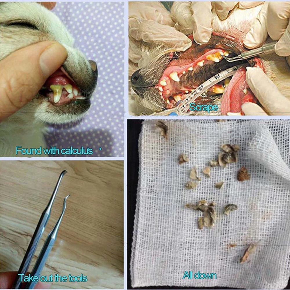 dental scaler