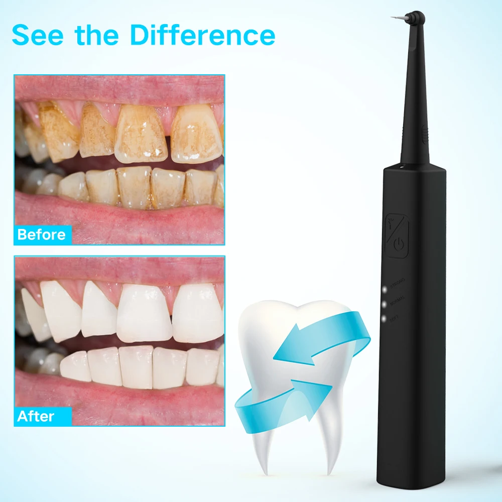 Dental calculus remover Electric Portable Oral Irrigation teeth whitening Tartar Scraper Health Hygiene Dropping Greenish Blue