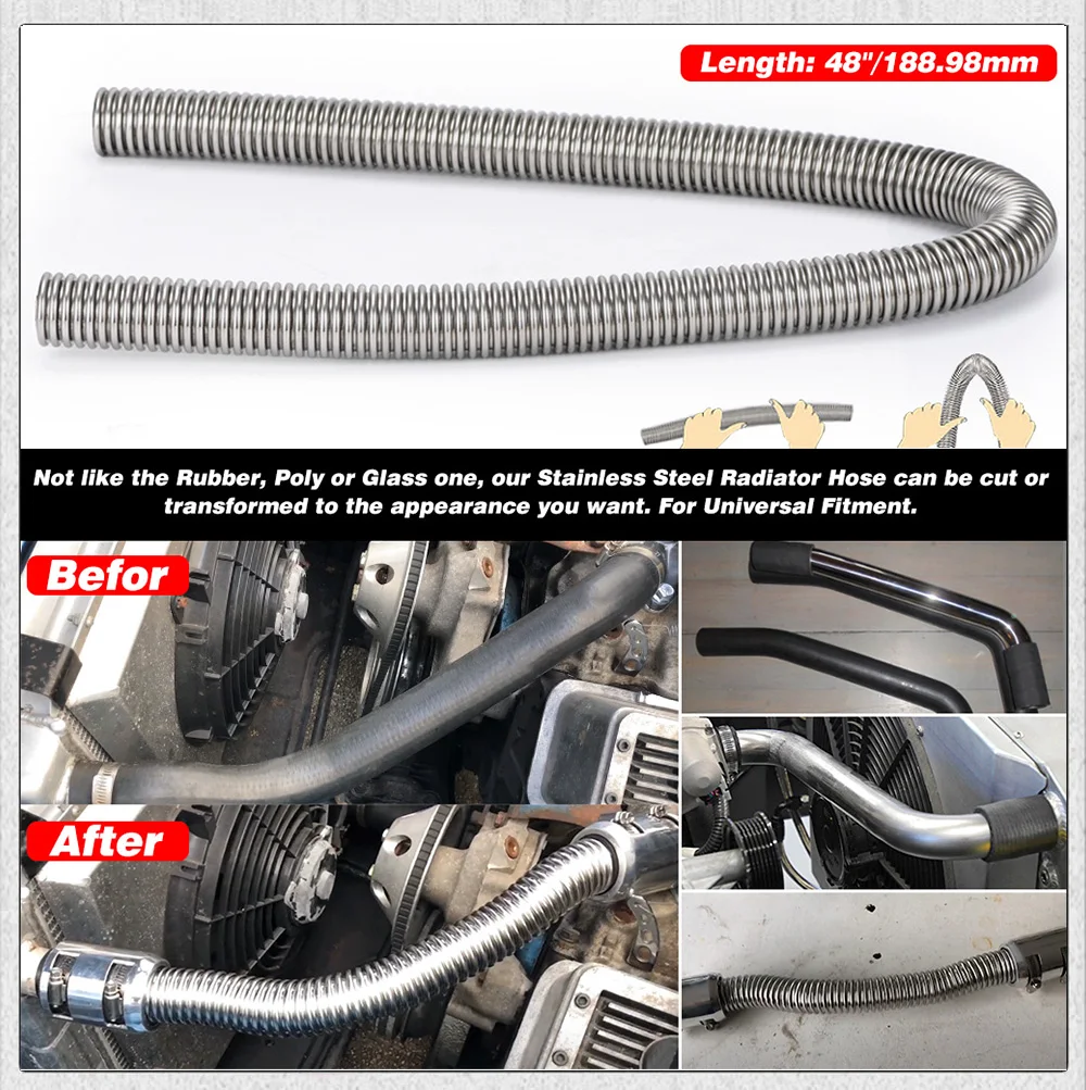 Stainless Steel Heat Dissipation Hose Kit with 4 Chrome Caps Somusen Silver Universal 48-inch Radiator Hose Kit