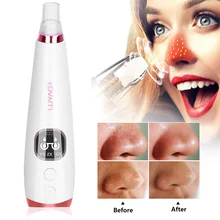 Для лица удаление прыщей Средство для удаления черных точек вакуумный очиститель пор аппарат для очистки пор для удаления черных точек пылесос для удаления черных точек вакуумное всасывание акне Очищение лица