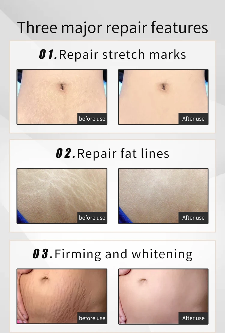 腹部修护霜详情页-英文_08