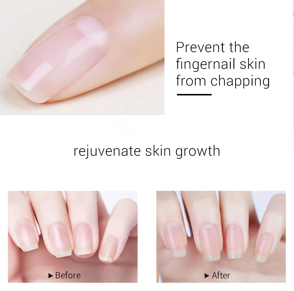 20ml Lily Cuticle Oil Revitalizer Nails Care Accesoires Supplies for