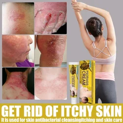 Skin Moss Removal Cream Moss Versicolor Sweat Spot Sweat Spot Itchy Skin Antibacterial Cream Skin Whitening Cream