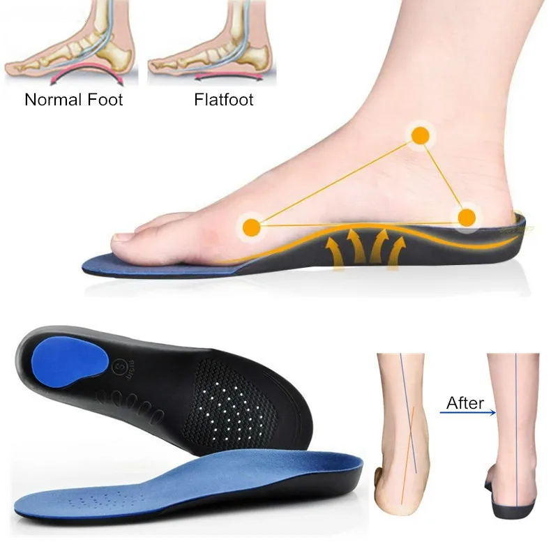 Orthotic Insoles EVA Adult Flat Foot Arch Support Orthotics Orthopedic For Men And Women Feet Health Care Pad Tool | Красота и