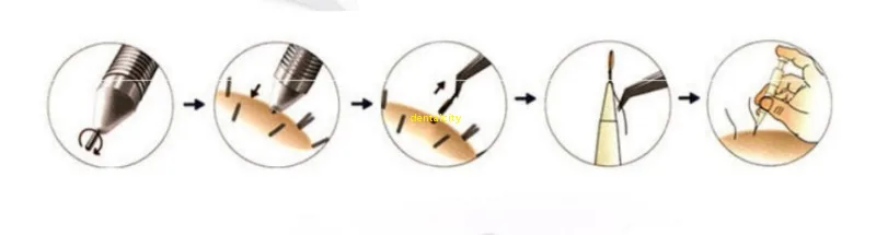 FUE машина для трансплантации волос хирургическая трансплантация волос FUE волосяной фолликул экстракция посадки волос/бровей/бороды оборудование